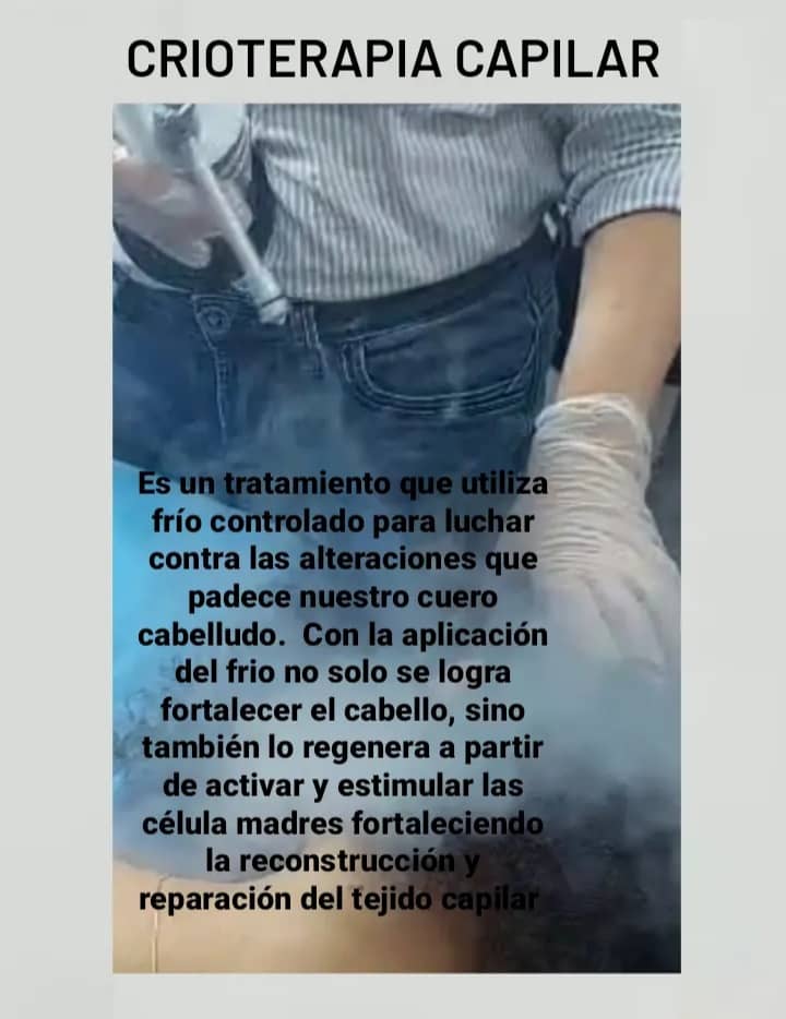 Crioterapia capilar