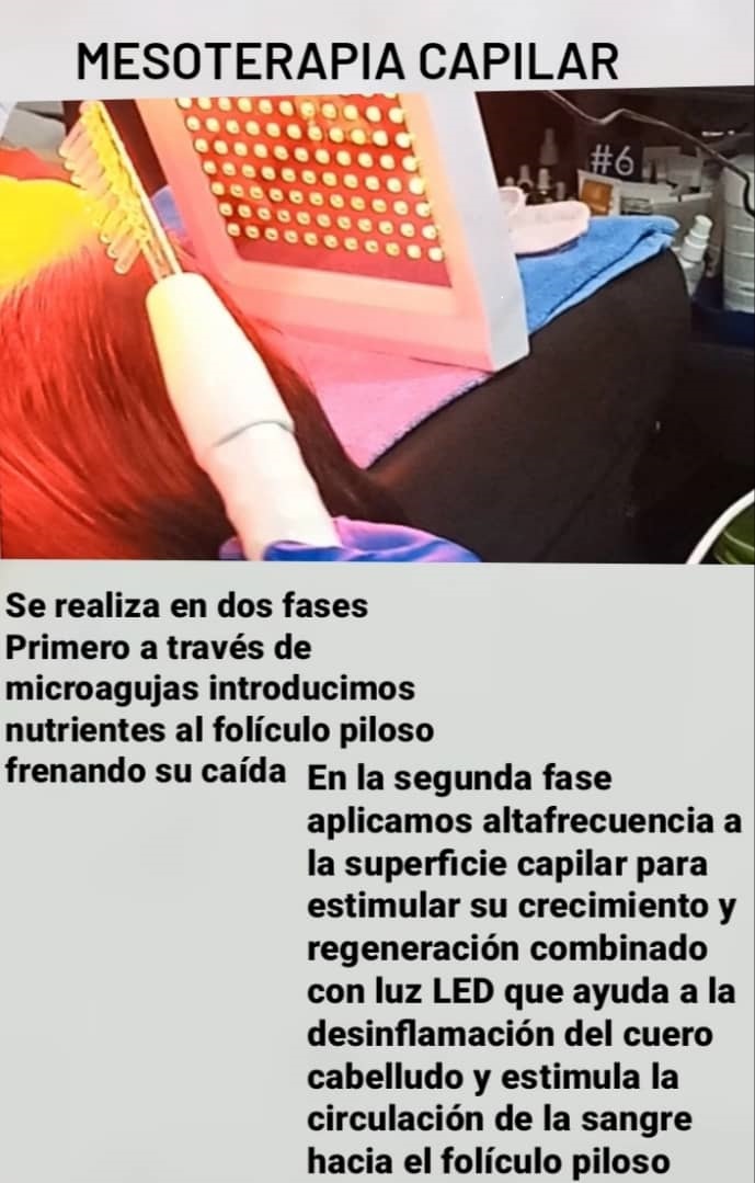 Mesoterapia capilar